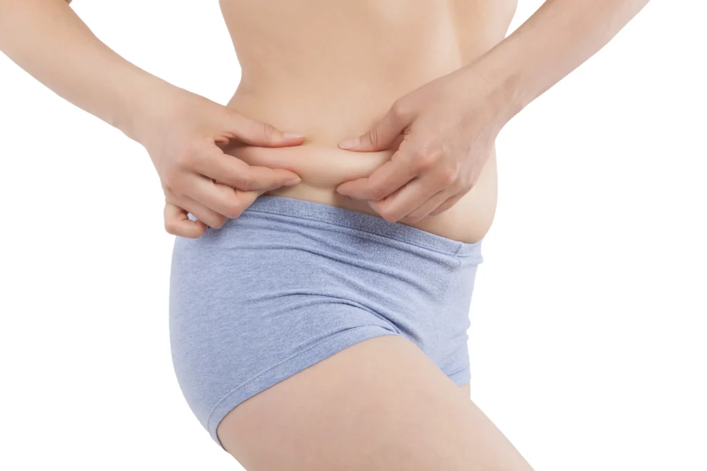 Liposuction, yağ aldırma