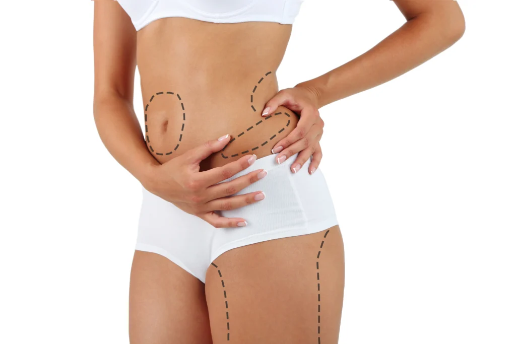 Antalya Liposuction ameliyatı